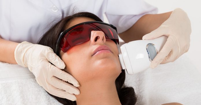 laser hair removal